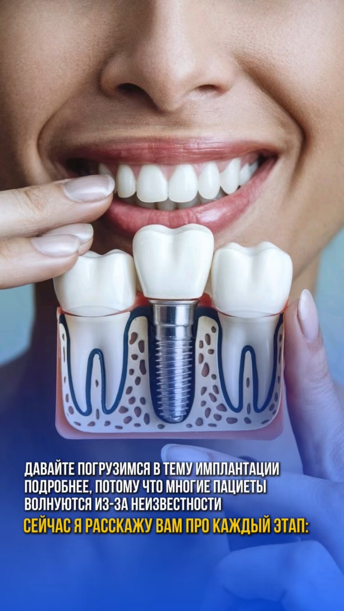 Имплантация — случай 1