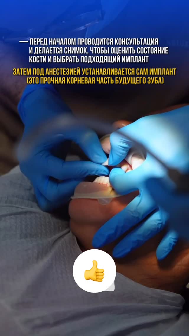 Имплантация — случай 2