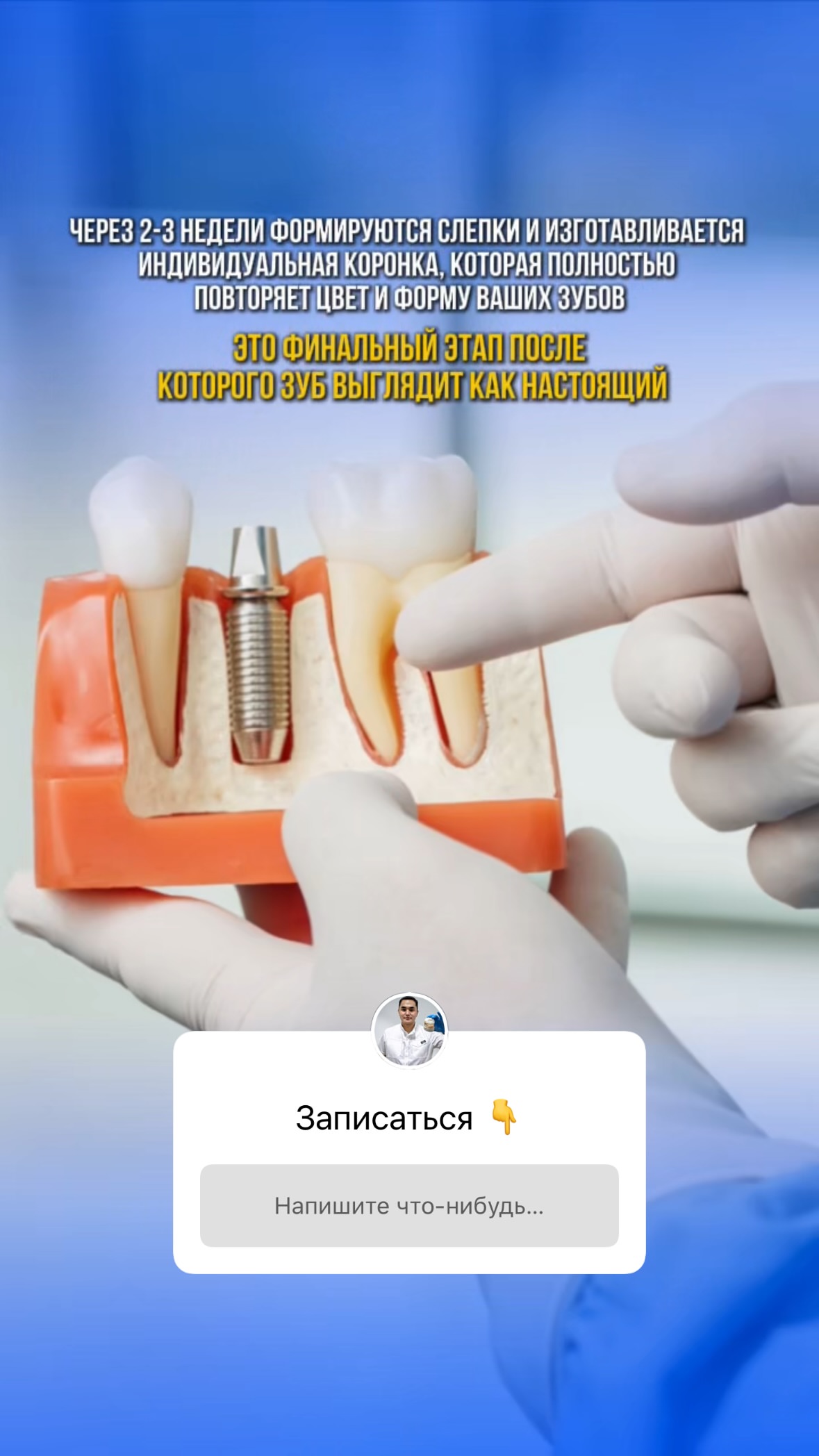 Имплантация — случай 4