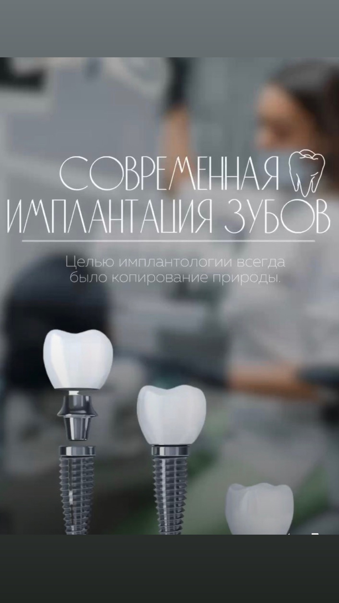 Имплантация — случай 8