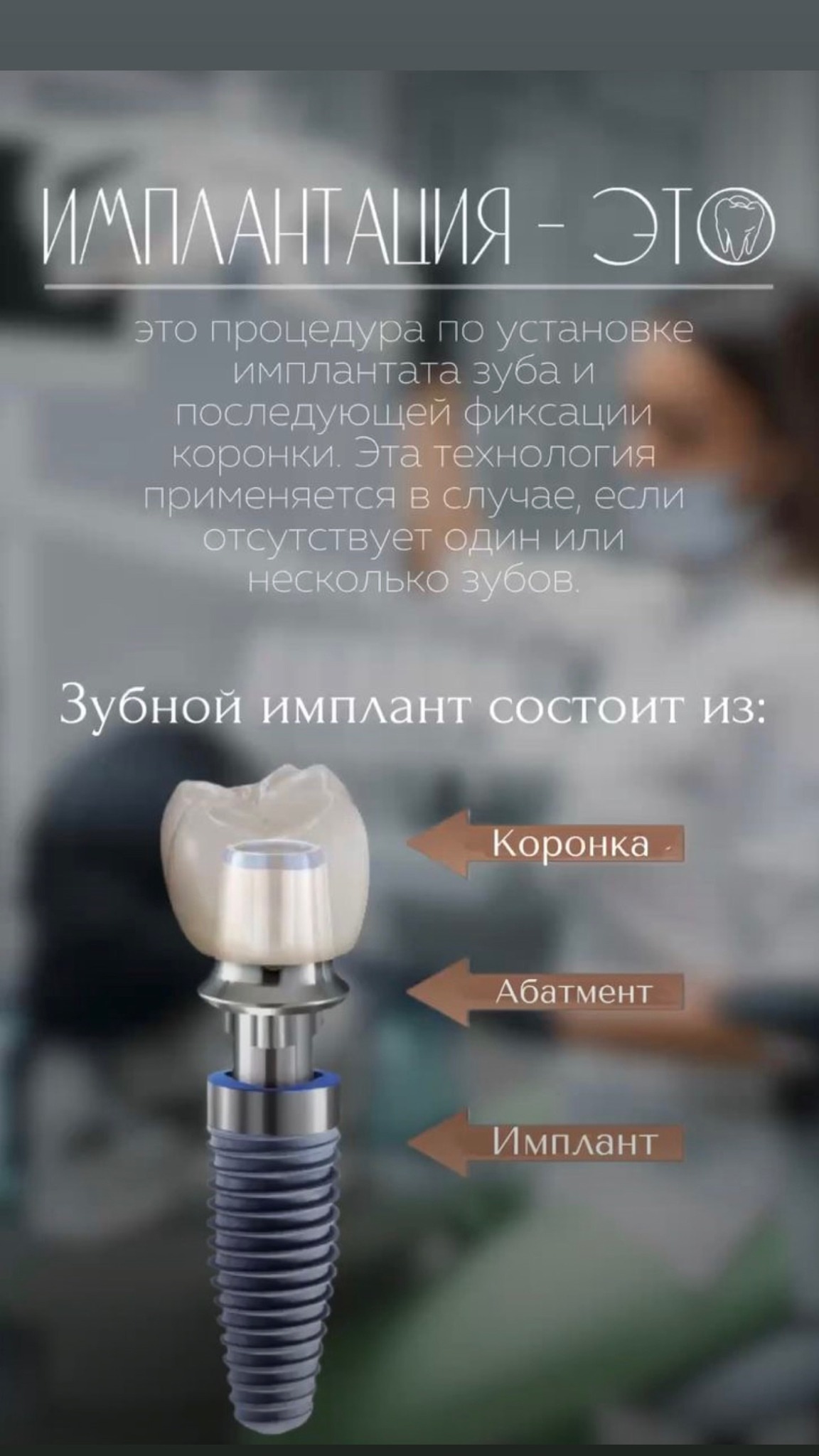 Имплантация — случай 9